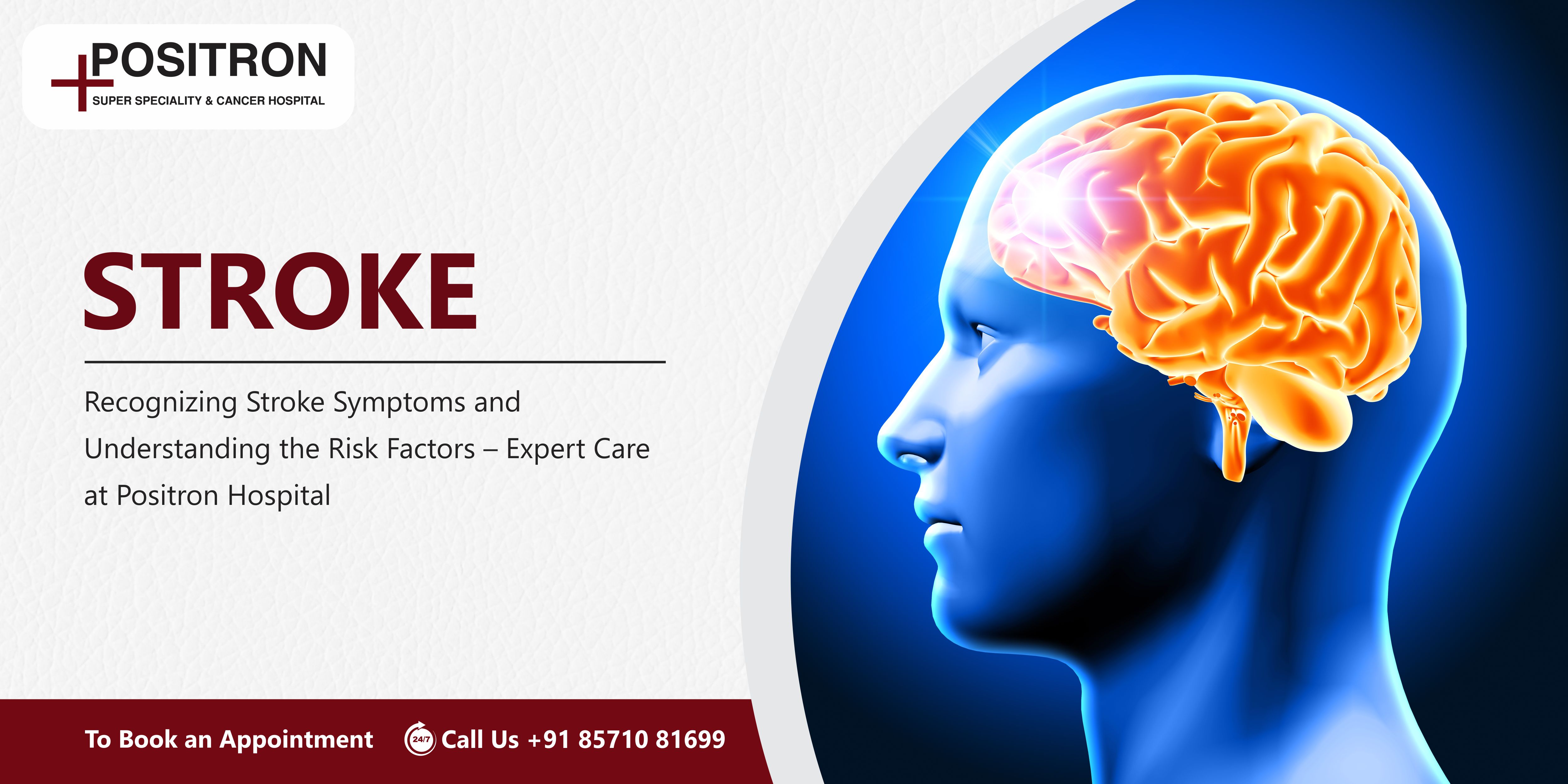 Recognizing Stroke Symptoms and Understanding the Risk Factors – Expert Care at Positron Hospital